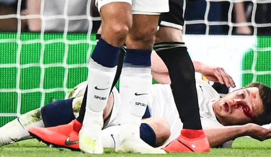 フェルトンゲンは一度はプレー続行も交代